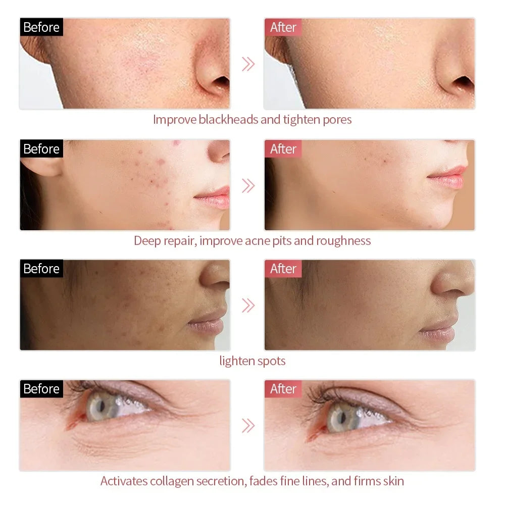 7 Colors LED Facial Mask - Wireless Face Care Treatment